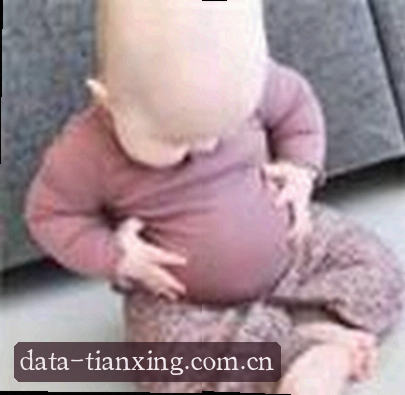 刘宇